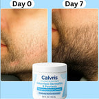 Flake Relief Cream